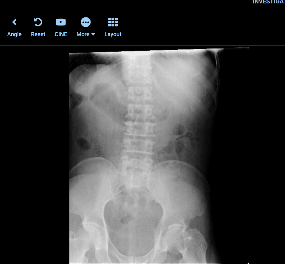 DycoSuite DICOM viewer showing an X-ray study